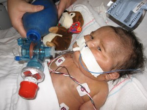 just before the hand off in OR