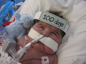 Jan. 09, 2009  100th Day at UCLA