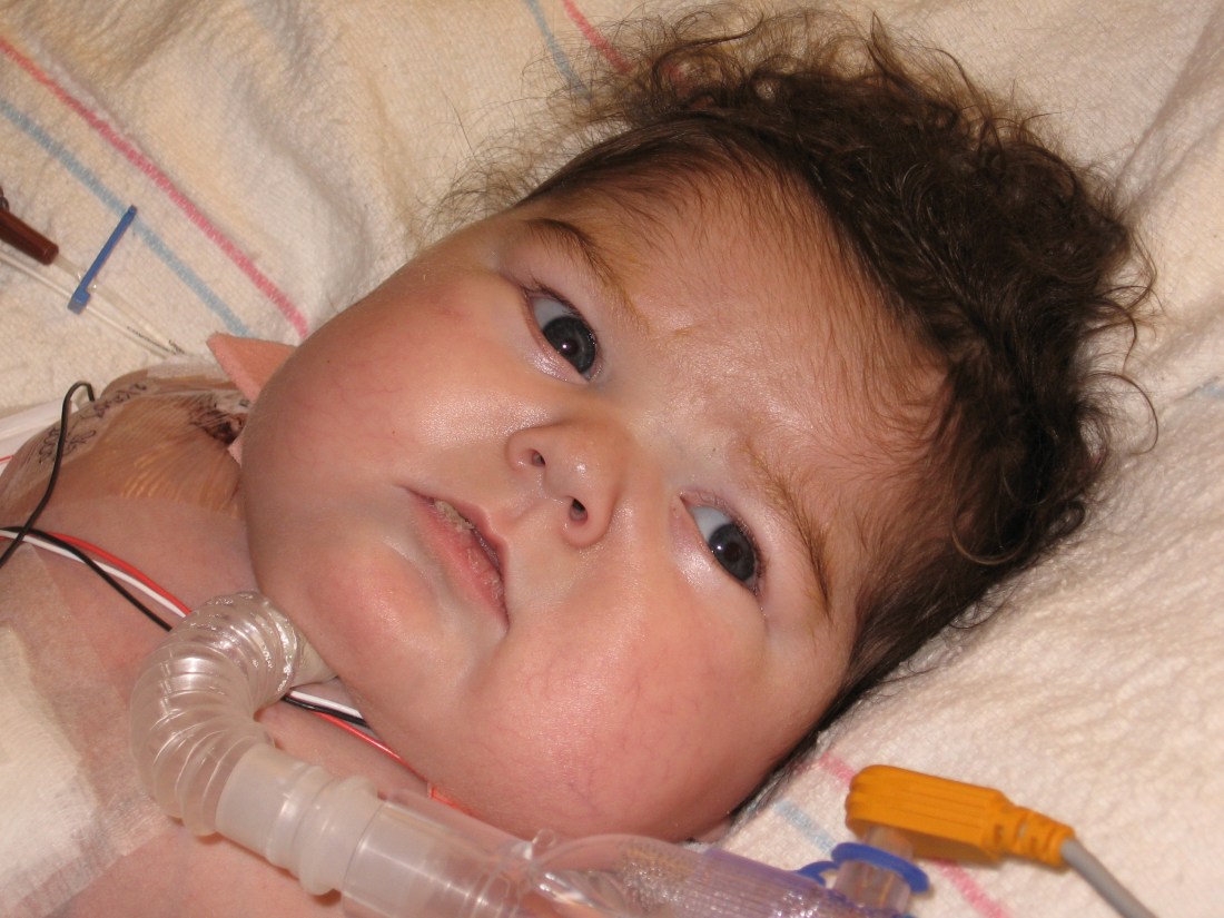 His body may look war-torn but his face is perfect!!! Happy 21-weeks little man...