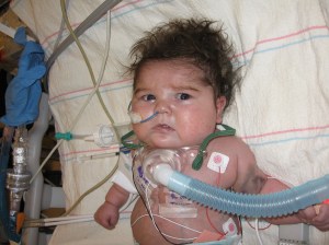 Rudy breathing on his own!