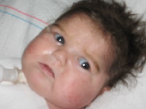 trach-day-2-10-09-002