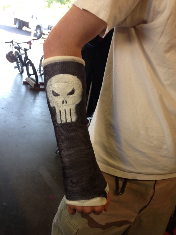 One is never to old to have one's favorite Marvel comic antihero logo spray-painted on his cast...thanks to Dad.