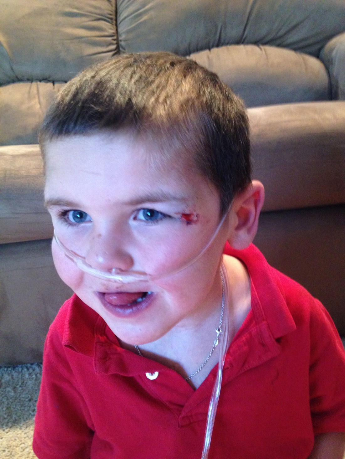 …he got a little street cred among the Black Sheep when he tipped his hog and got himself a nice shiner!!!